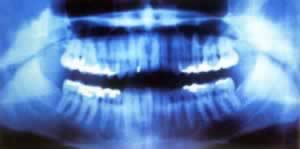 X射线公诸于世（历史上今天lssjt.cn）